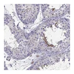 Atlas Antibodies Anti-PGK2 Antibody