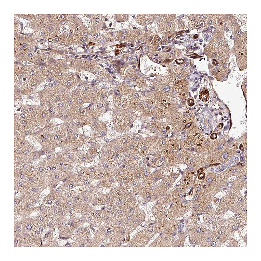 Atlas Antibodies Anti-PGLYRP2 Antibody