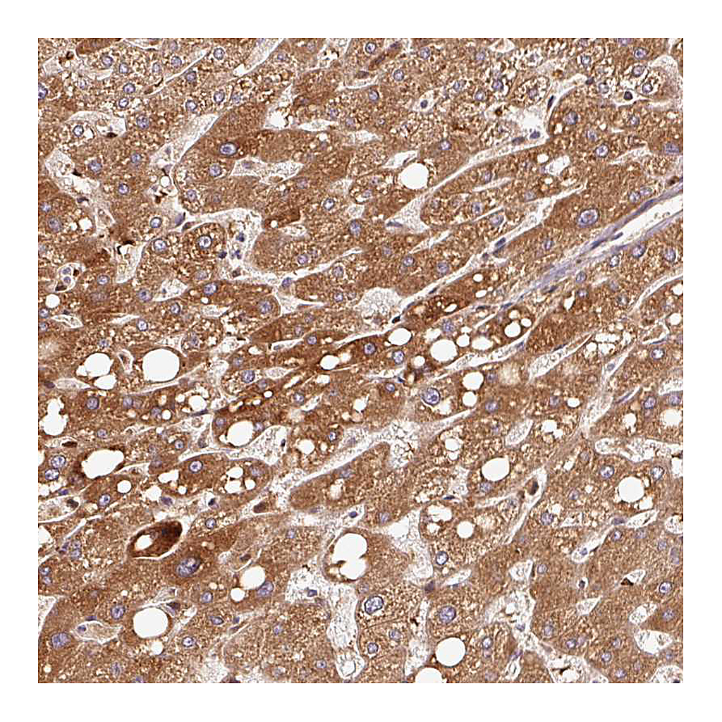Atlas Antibodies Anti-PGLYRP2 Antibody