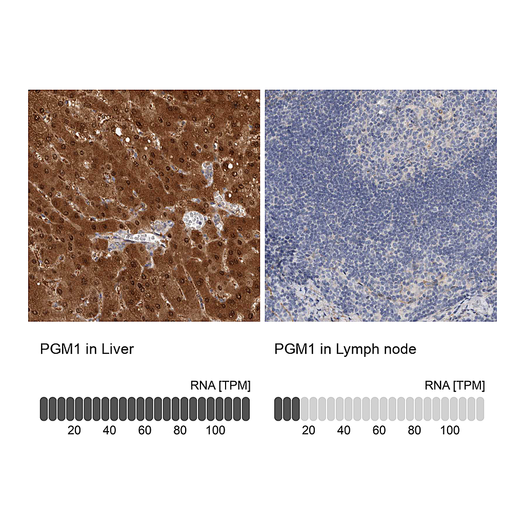 Atlas Antibodies Anti-PGM1 Antibody