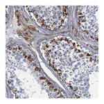 Atlas Antibodies Anti-PGM2 Antibody