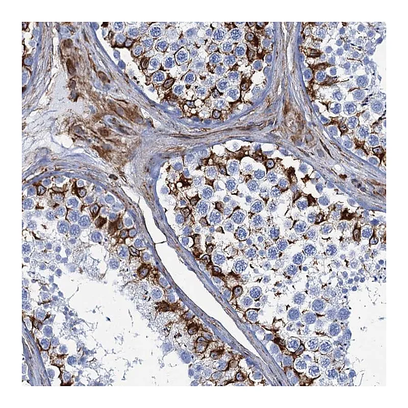 Atlas Antibodies Anti-PGM2 Antibody