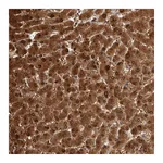 Atlas Antibodies Anti-PGM1 Antibody