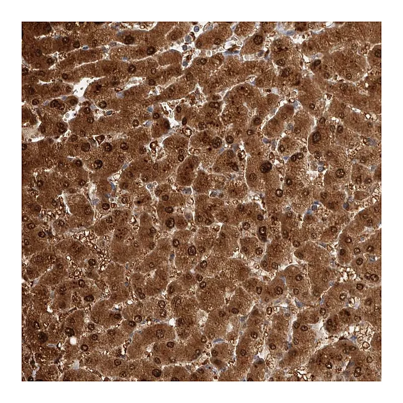 Atlas Antibodies Anti-PGM1 Antibody