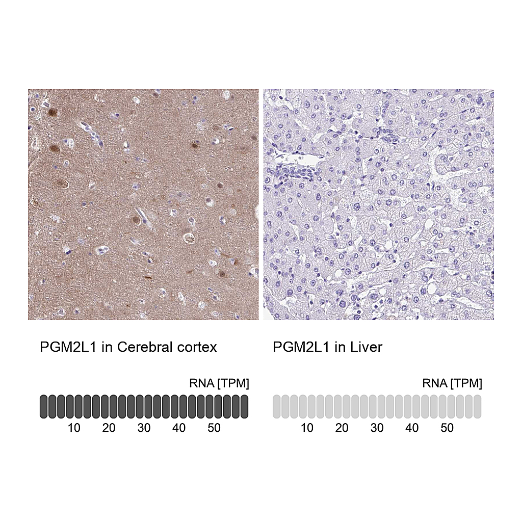 Atlas Antibodies Anti-PGM2L1 Antibody