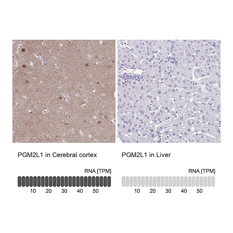 Atlas Antibodies Anti-PGM2L1 Antibody