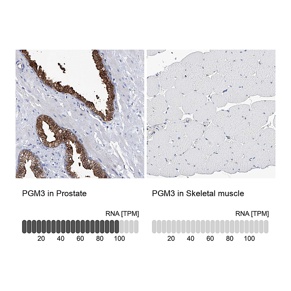 Atlas Antibodies Anti-PGM3 Antibody