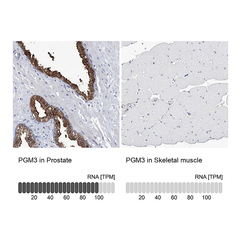 Atlas Antibodies Anti-PGM3 Antibody