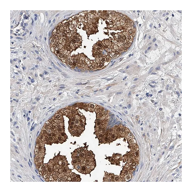 Atlas Antibodies Anti-PGM3 Antibody