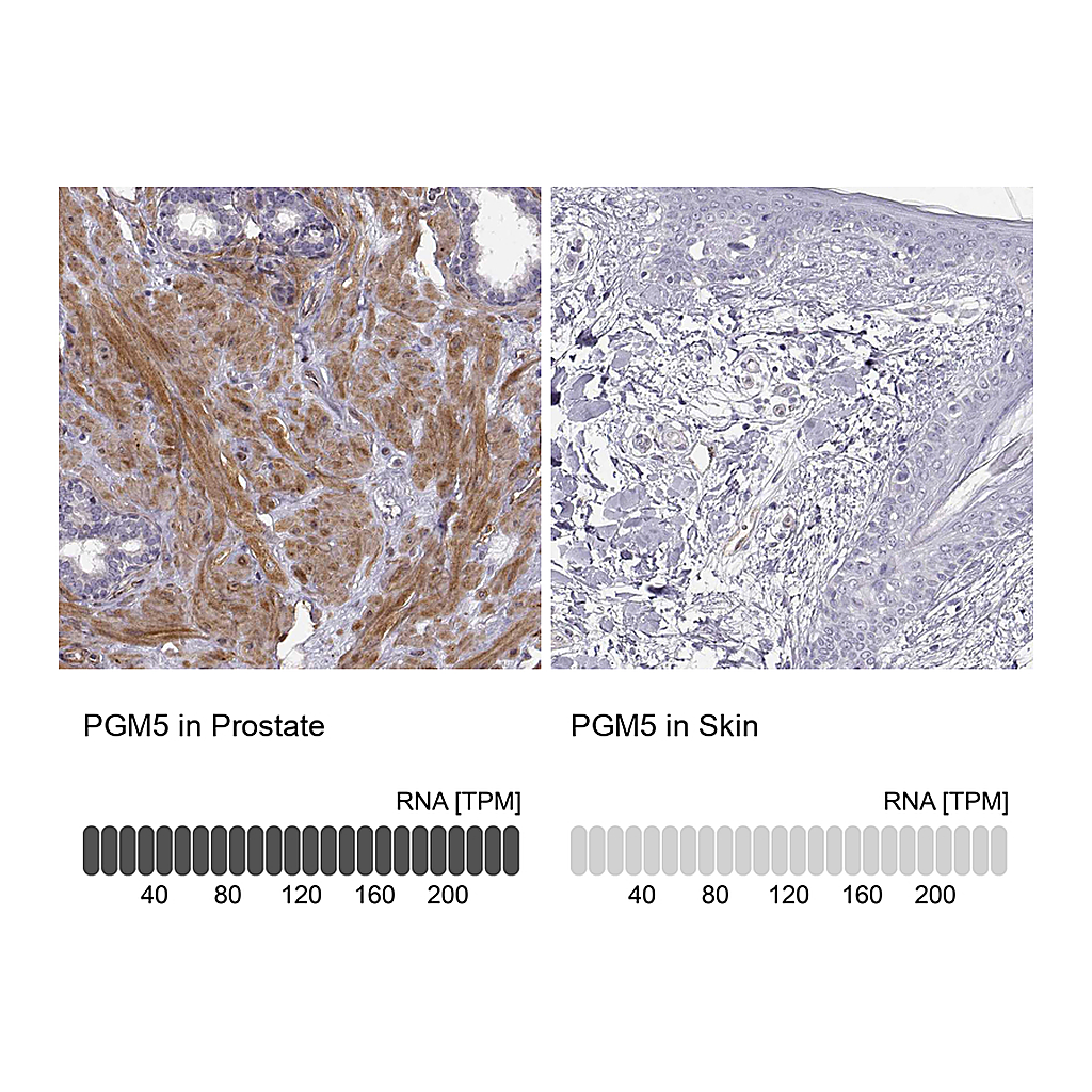 Atlas Antibodies Anti-PGM5 Antibody