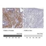 Atlas Antibodies Anti-PGM5 Antibody
