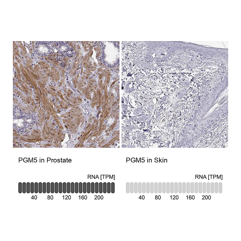 Atlas Antibodies Anti-PGM5 Antibody