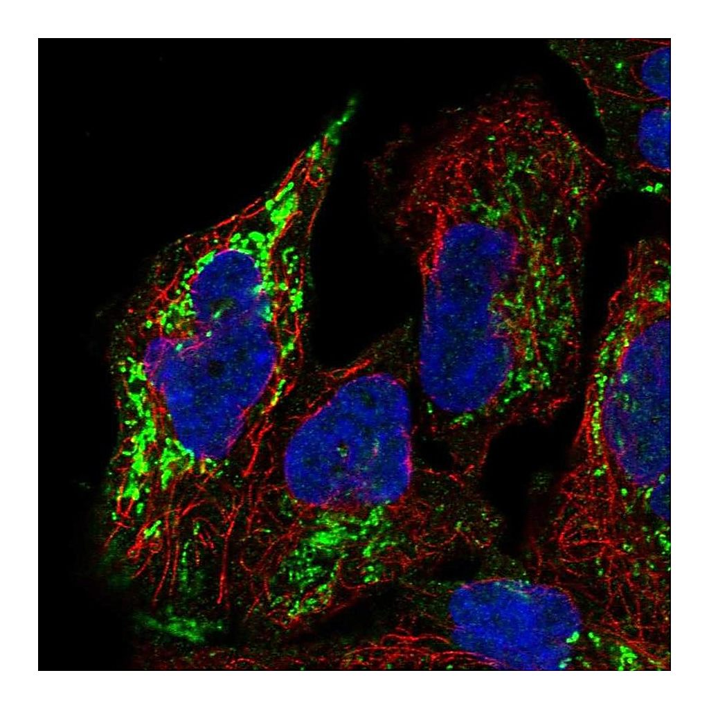 Atlas Antibodies Anti-PGM2L1 Antibody