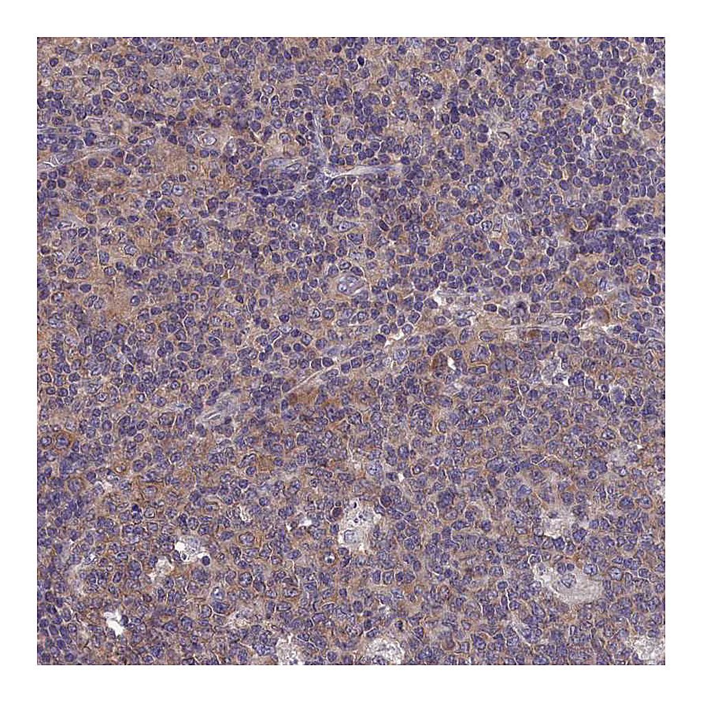 Atlas Antibodies Anti-PGP Antibody