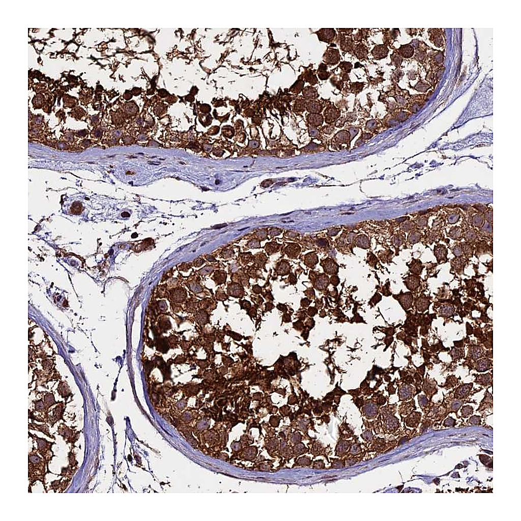 Atlas Antibodies Anti-PGPEP1L Antibody