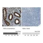Atlas Antibodies Anti-PGR Antibody