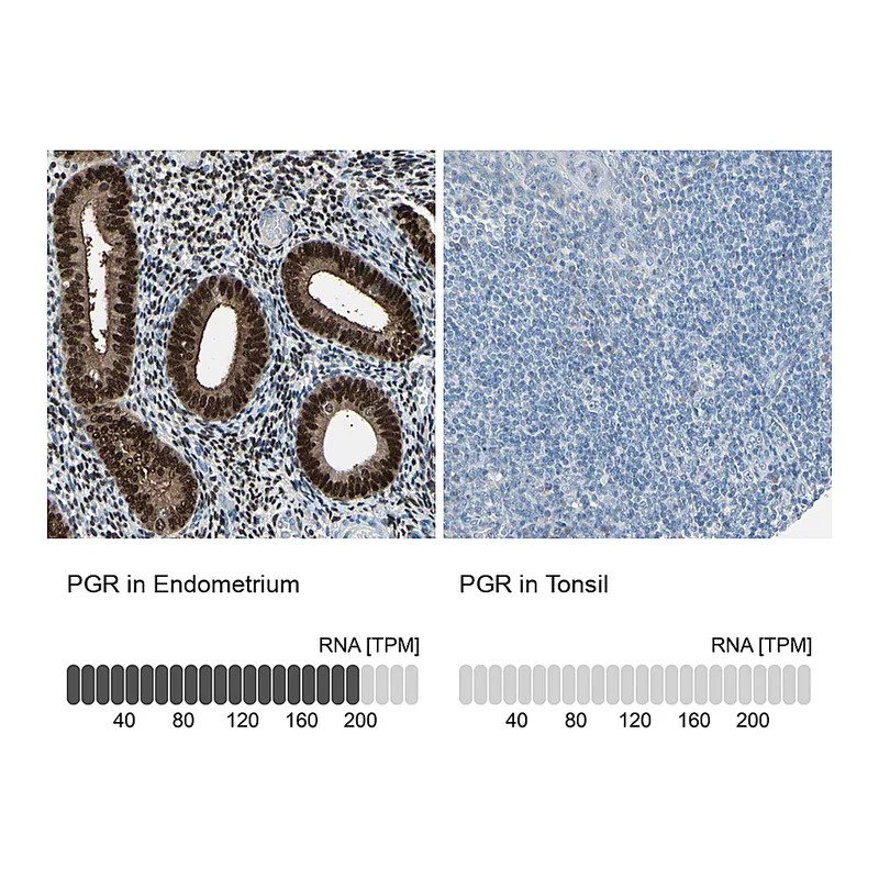 Atlas Antibodies Anti-PGR Antibody