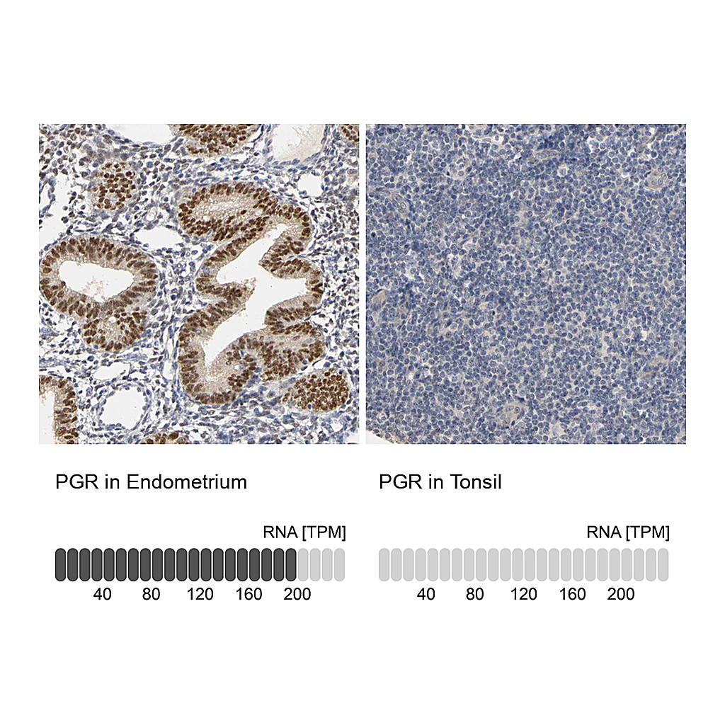 Atlas Antibodies Anti-PGR Antibody