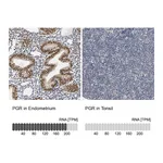 Atlas Antibodies Anti-PGR Antibody