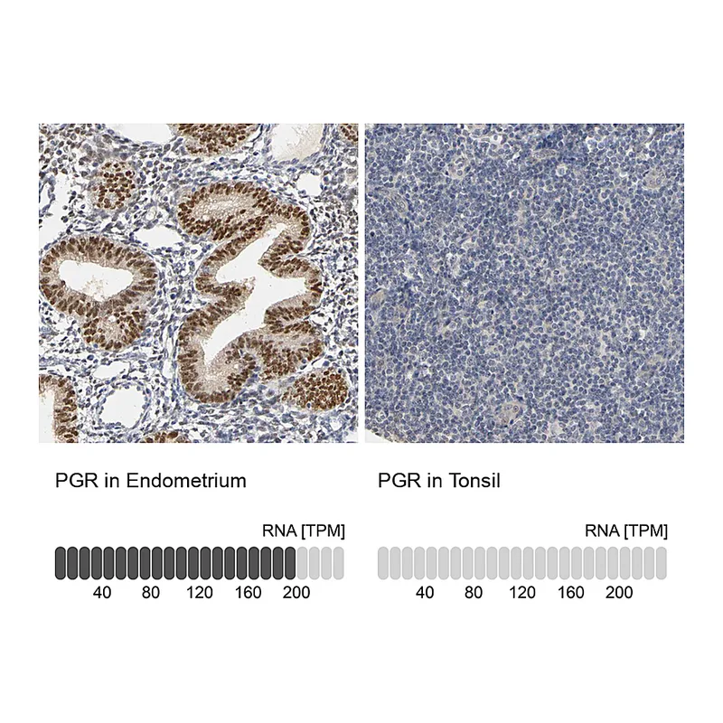 Atlas Antibodies Anti-PGR Antibody