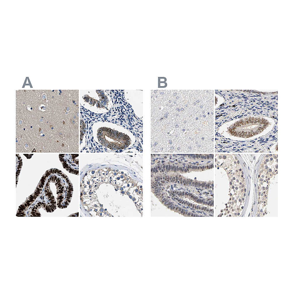 Atlas Antibodies Anti-PGR Antibody