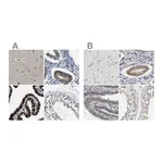 Atlas Antibodies Anti-PGR Antibody