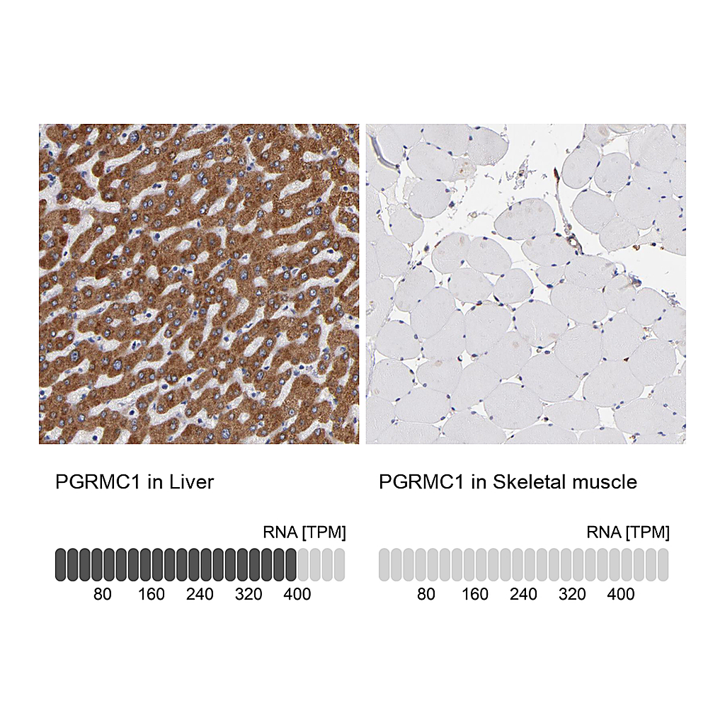 Atlas Antibodies Anti-PGRMC1 Antibody
