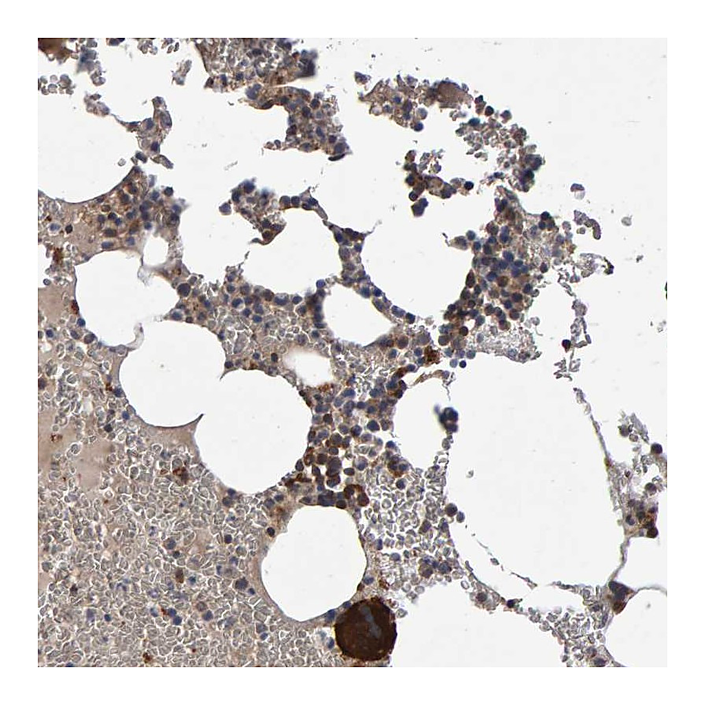 Atlas Antibodies Anti-PGS1 Antibody