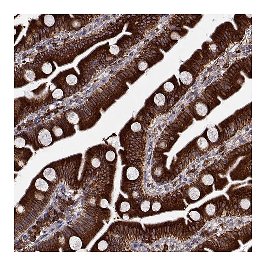 Atlas Antibodies Anti-PGRMC2 Antibody