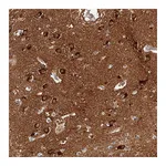 Atlas Antibodies Anti-PHACTR1 Antibody