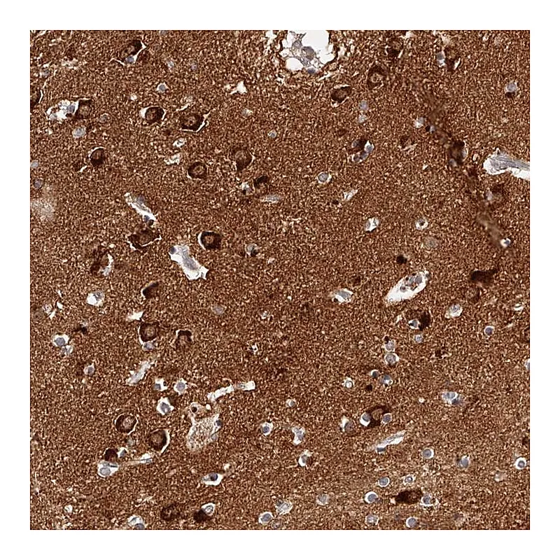Atlas Antibodies Anti-PHACTR1 Antibody