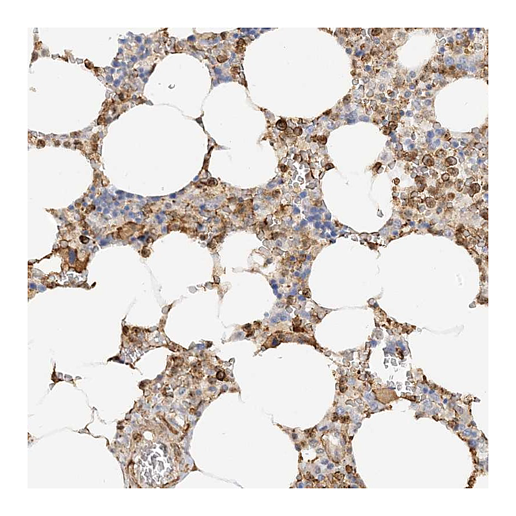 Atlas Antibodies Anti-PHACTR2 Antibody