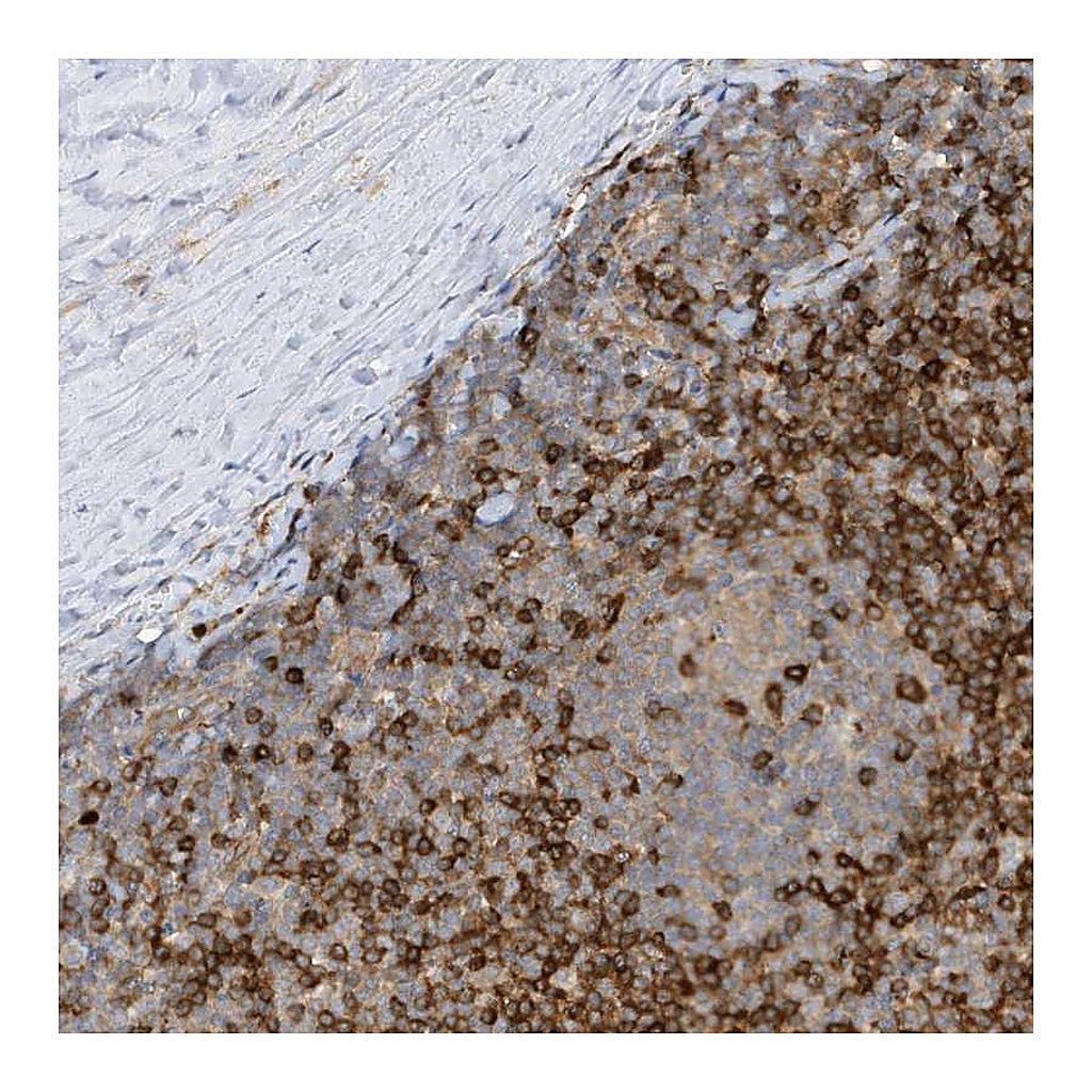 Atlas Antibodies Anti-PHACTR2 Antibody