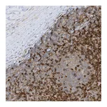 Atlas Antibodies Anti-PHACTR2 Antibody