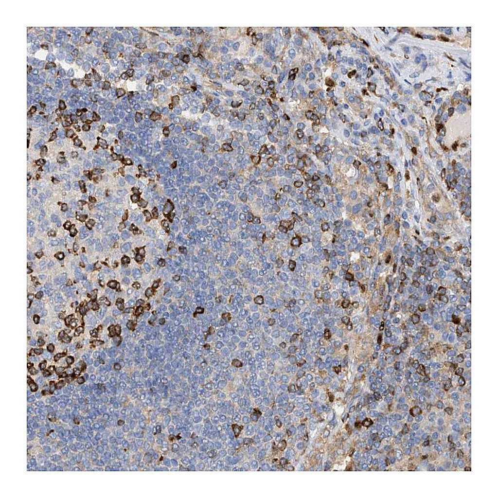 Atlas Antibodies Anti-PHACTR2 Antibody