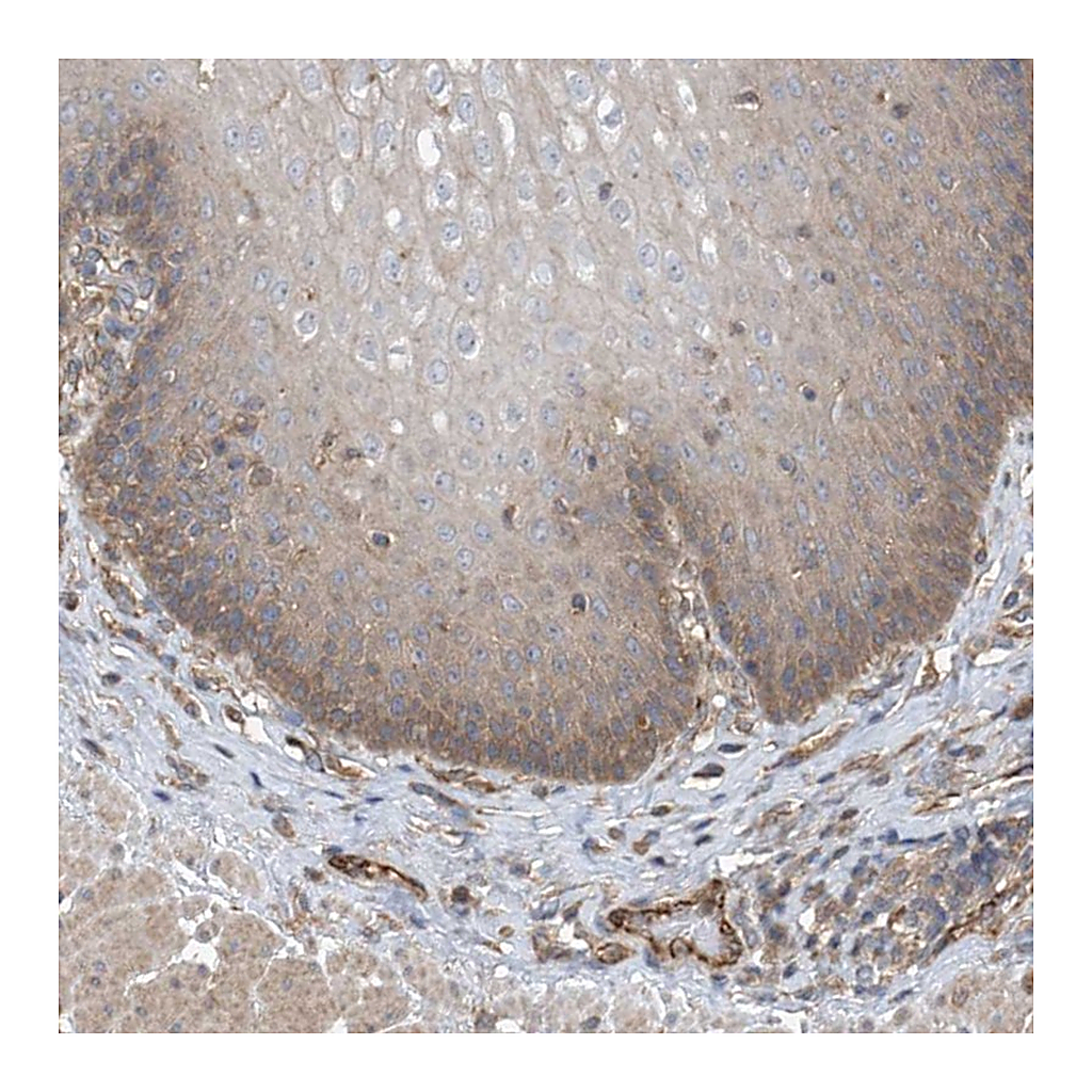 Atlas Antibodies Anti-PHACTR4 Antibody