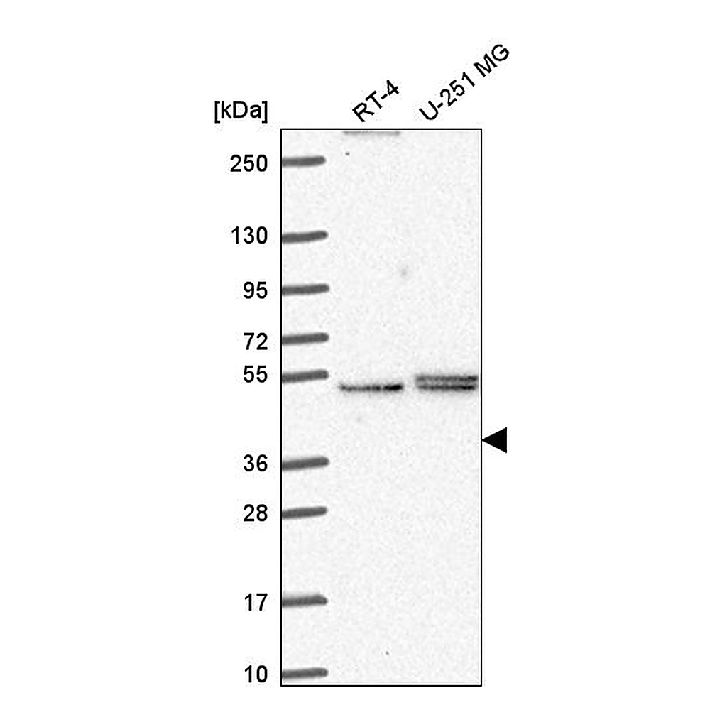 Atlas Antibodies Anti-PHAX Antibody