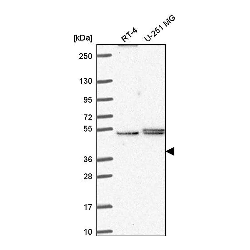 Atlas Antibodies Anti-PHAX Antibody