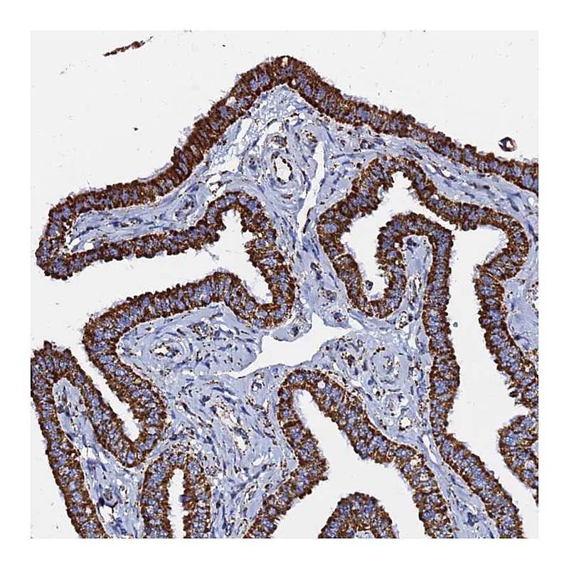 Atlas Antibodies Anti-PHB2 Antibody