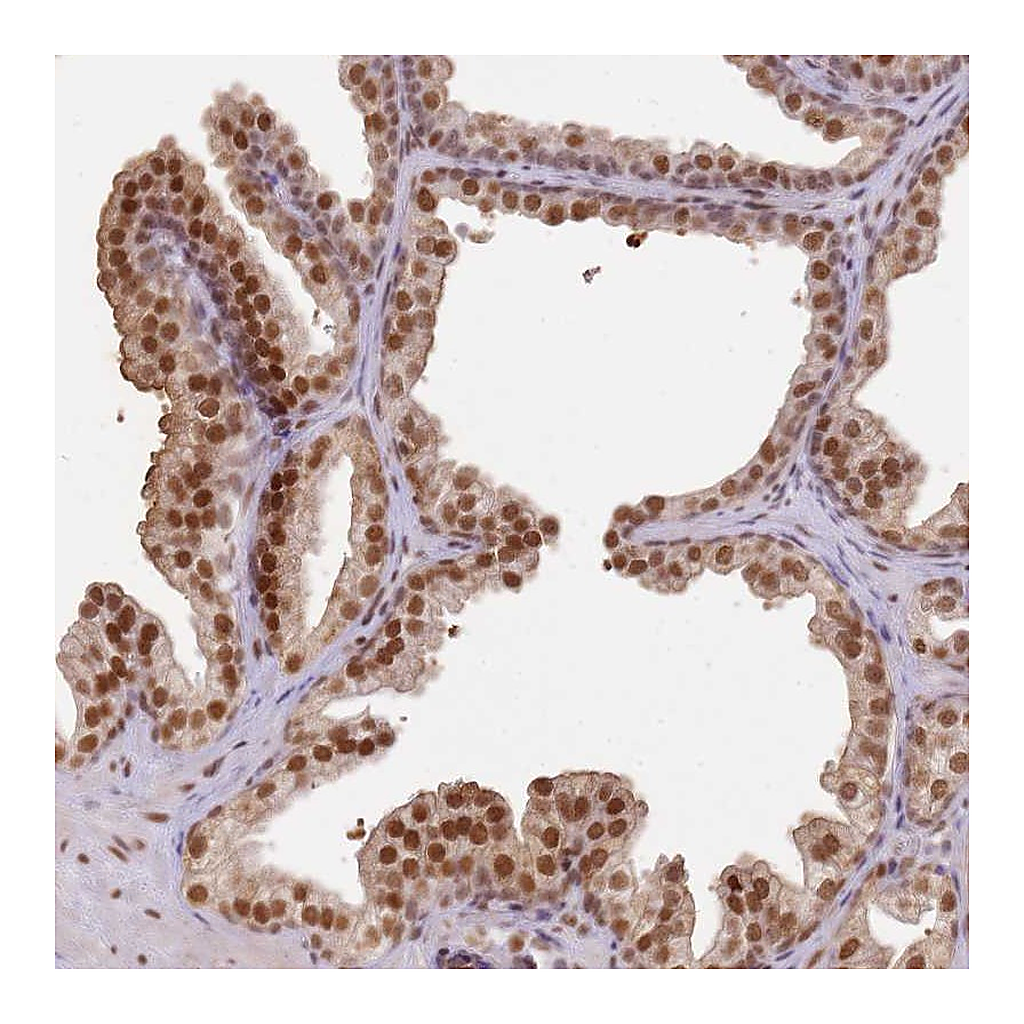 Atlas Antibodies Anti-PHC2 Antibody