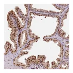 Atlas Antibodies Anti-PHC2 Antibody