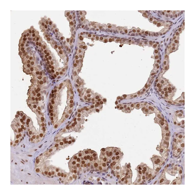 Atlas Antibodies Anti-PHC2 Antibody