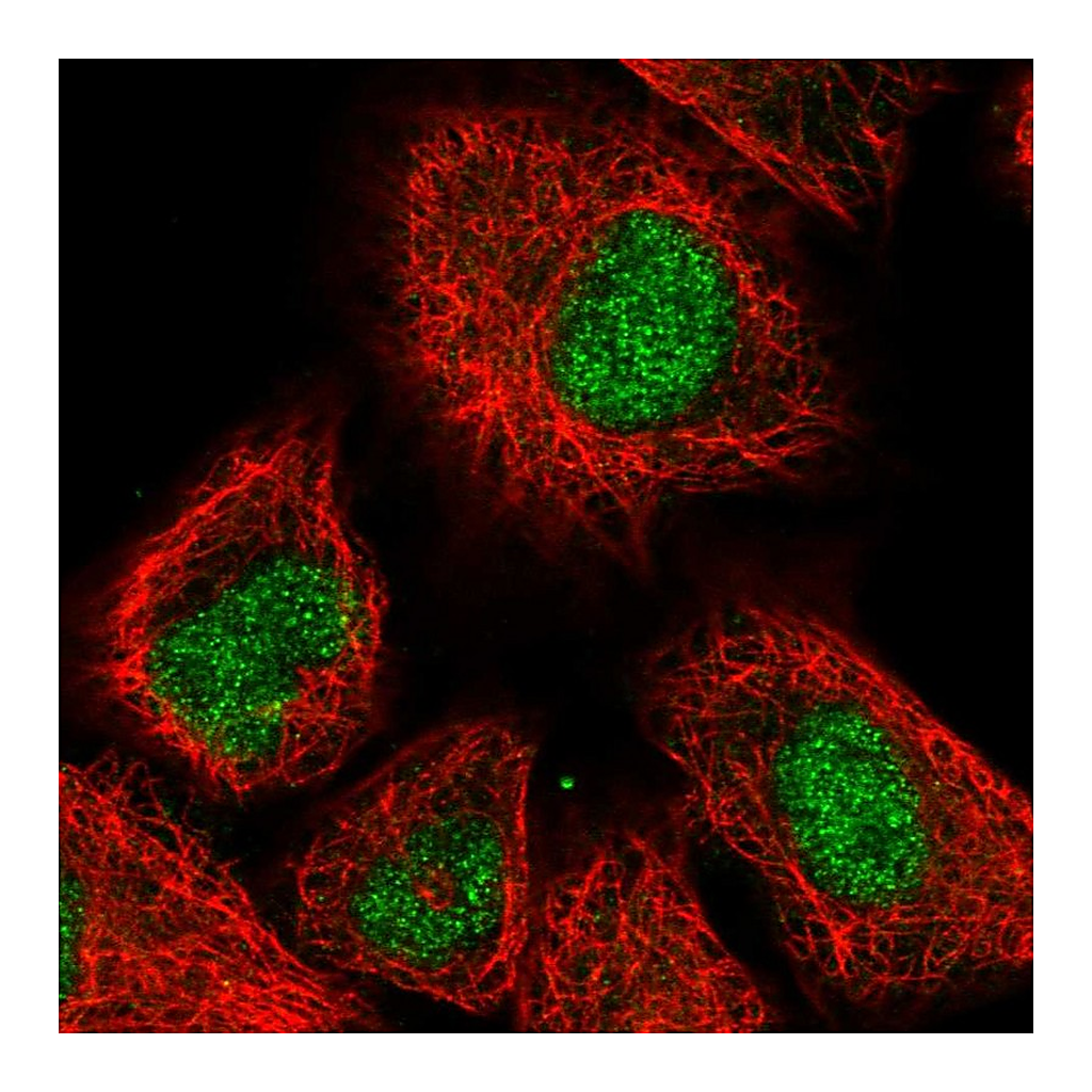 Atlas Antibodies Anti-PHC3 Antibody