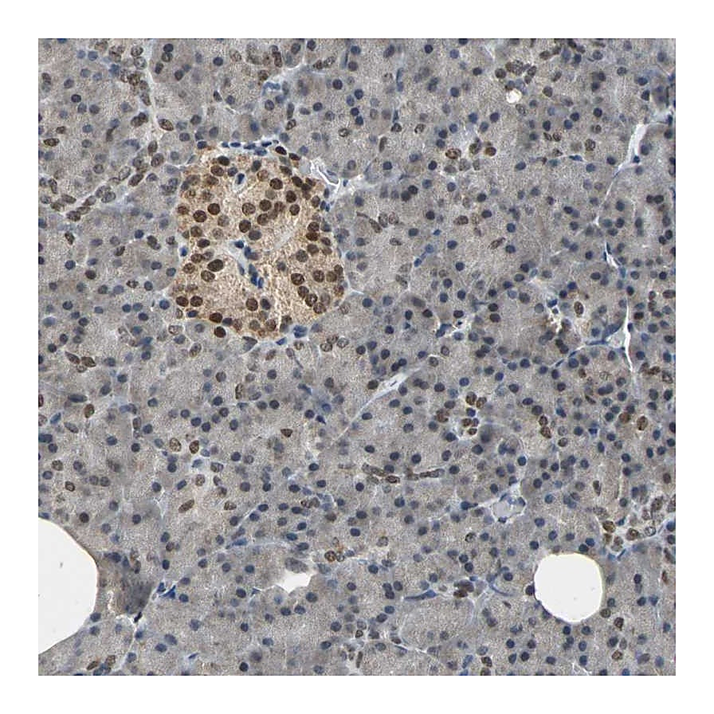 Atlas Antibodies Anti-PHC1 Antibody