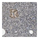 Atlas Antibodies Anti-PHC1 Antibody