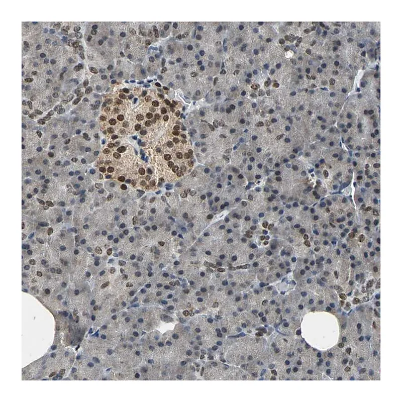 Atlas Antibodies Anti-PHC1 Antibody