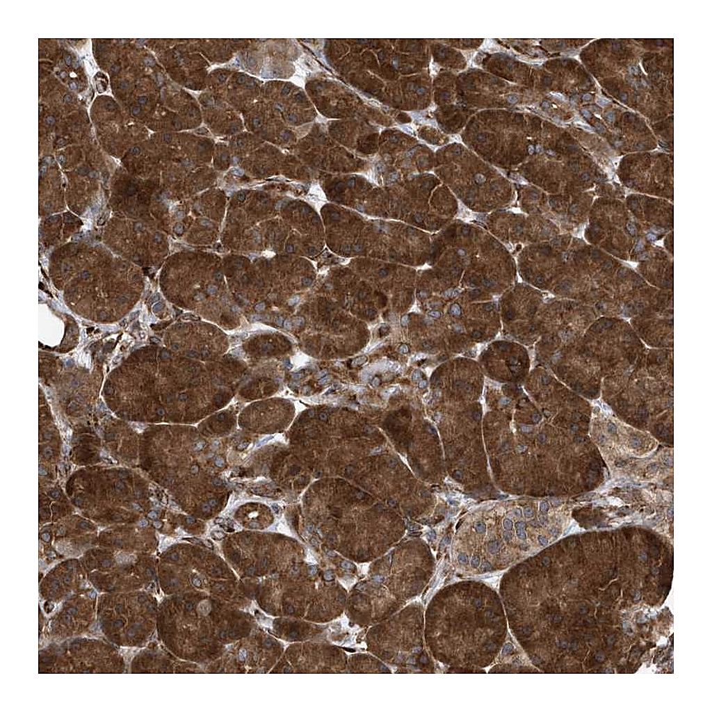 Atlas Antibodies Anti-PHF1 Antibody