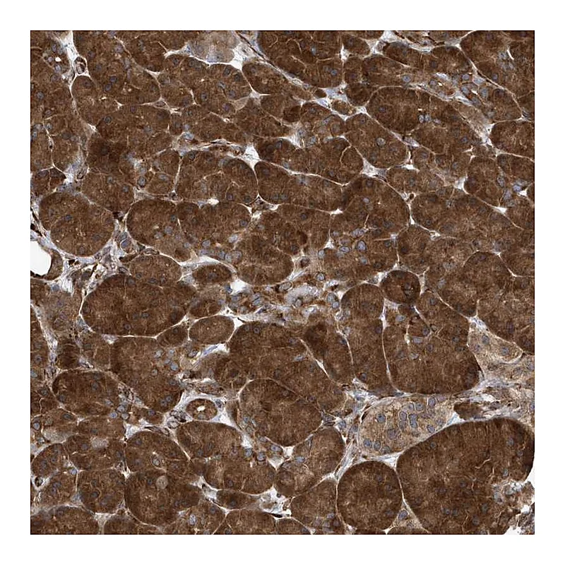 Atlas Antibodies Anti-PHF1 Antibody
