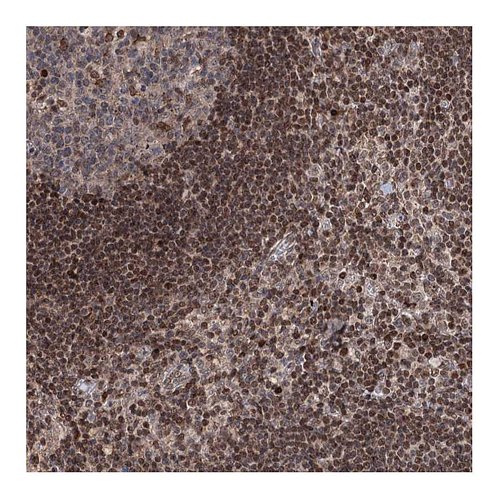 Atlas Antibodies Anti-PHC3 Antibody