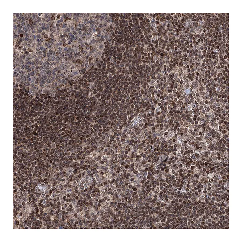 Atlas Antibodies Anti-PHC3 Antibody